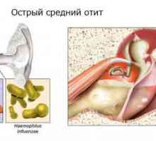 Učinkovitost liječenja upale srednjeg uha antibioticima