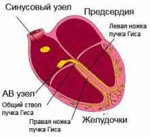 Bolesti kardiovaskularnog sustava (kardiovaskularne bolesti): pregled, simptomi, principi liječenja