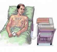 Elektrokardiografija (EKG): osnovno teorije, uklanjanje analiza, detekcija patologija