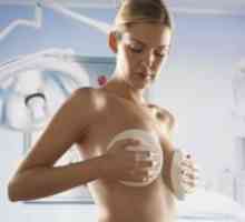 Endoproteze mliječne žlijezde kao metodu rekonstrukcije nakon mastektomije
