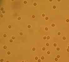 Crvene krvne stanice u urinu