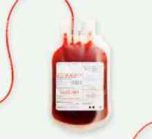 Kako donirati davatelja krvi: isporuka red