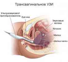 Kako vaginalni ultrazvuk: pripremu, postupak i dekodiranje