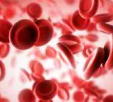 Kako i što liječiti anemiju