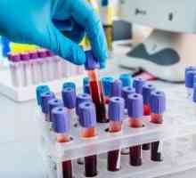Kako i zašto je krvni test za šećer s opterećenjem?