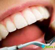 Koliko god da boli desni poslije vađenja zuba? Patološki uzroci i liječenje