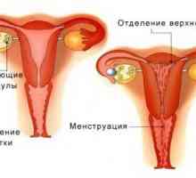 Kako ćete zaustaviti menstruaciju ako idu dugo?