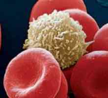 Kako povećati bijelih krvnih stanica u krvi nakon kemoterapije?