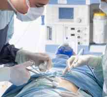 Kako je uklanjanje maternice laparoskopski?