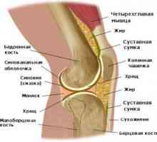 Koji su simptomi artritisa koljena