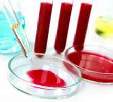Kako da se test krvi za Giardia
