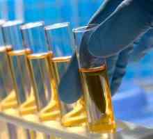Kako se i koji identificira kemijsko-toksikološku analizu urina?