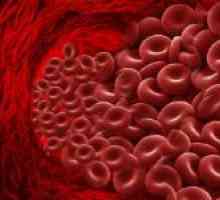 Kako smanjiti hemoglobina u krvi: prehrana, lijekovi i tradicionalni recepti
