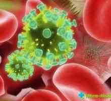 Kako bi stekli HIV infekcije: sve što trebate znati o virusu