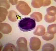 Što je stopa limfocita u krvi i njihovih funkcija