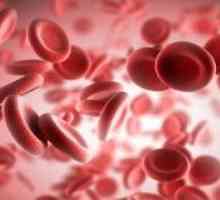 Što pokazatelji u krvi limfocita u žena smatra normalnim? Limfocitoza i limfopenija.