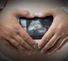 Kakve posljedice čekaju ženu nakon nekog izvanmaternične trudnoće?