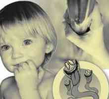 Koje su preporuke za liječenje Giardia u djece? Izbjegavajte infekcije djeteta s bolešću.