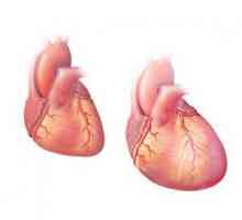 Kardiomcgalijc: oba oblika, simptomi, dijagnoza, posebno u djece, liječenje