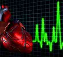 Kardiomiopatija - što je ovo bolest?