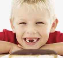 Zubni karijes i njegovi uzroci