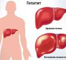 Hepatitis Clinic da: akutnih i kroničnih oblika
