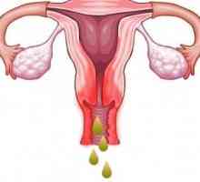 Coleitis za vrijeme menstruacije