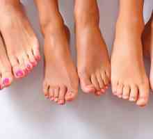 Svrbež kože na nogama: prevenciju i liječenje