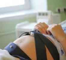 CTG fetusa tijekom trudnoće (ultrazvuk)