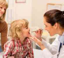 Liječenje infektivne mononukleoze u djece
