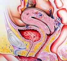 Liječenje endometrioze narodnih lijekova