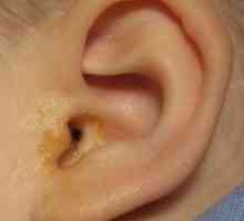 Liječenje uši izlučevinama