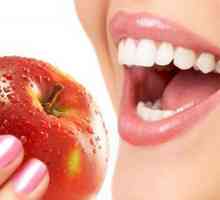 Mi liječenje upale zubnog mesa