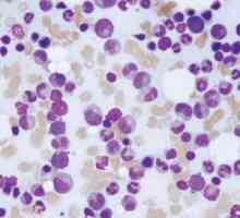 Leukocitoza, kada i zašto je, oblici, klasifikacija i funkcija leukocita