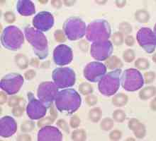 Limfociti u ljudskoj krvi