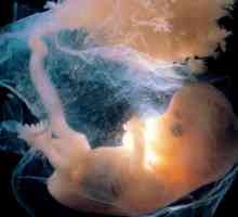 Majčino tijelo - 10 tjedana trudna