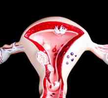 Krvarenje iz maternice: 23 razloga da to nazivamo proces