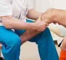 Lijek i bez lijeka za liječenje artritisa koljena