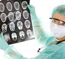 Meningeoma mozga: Implikacije nakon operacije