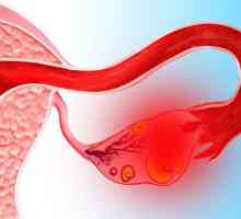 Menstruacija nakon kapi jajnika 2