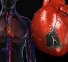 Kako spriječiti infarkt miokarda