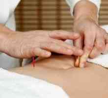 Mogu li koristiti akupunkturu u liječenju neplodnosti?
