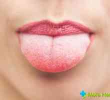 Plaketa bijeli jezik: uzroci, liječenje i prevencija