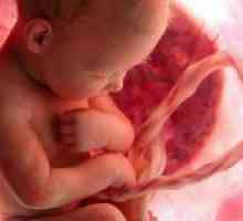 Povreda utero-posteljice protoka krvi za vrijeme trudnoće