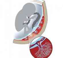 Oslabljeno protok krvi u arterijama maternice, pupčana vrpca, placenta tijekom trudnoće (nmpk)