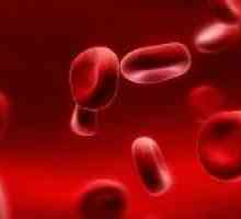Nasljednih i prirođenih hemolitička anemija u djece i odraslih