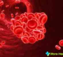 Natrij u krvi: norma, hiponatrijemija, gipernatiemiya