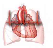 Male anomalije razvoja srca (MAR), to jest, oblika i posljedice liječenja