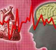 Nestabilne angine Heart