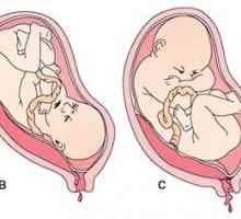 Niska placenta previa